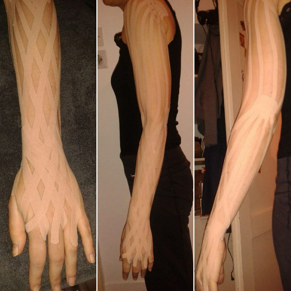 Kinezio taping - donji deo leđa