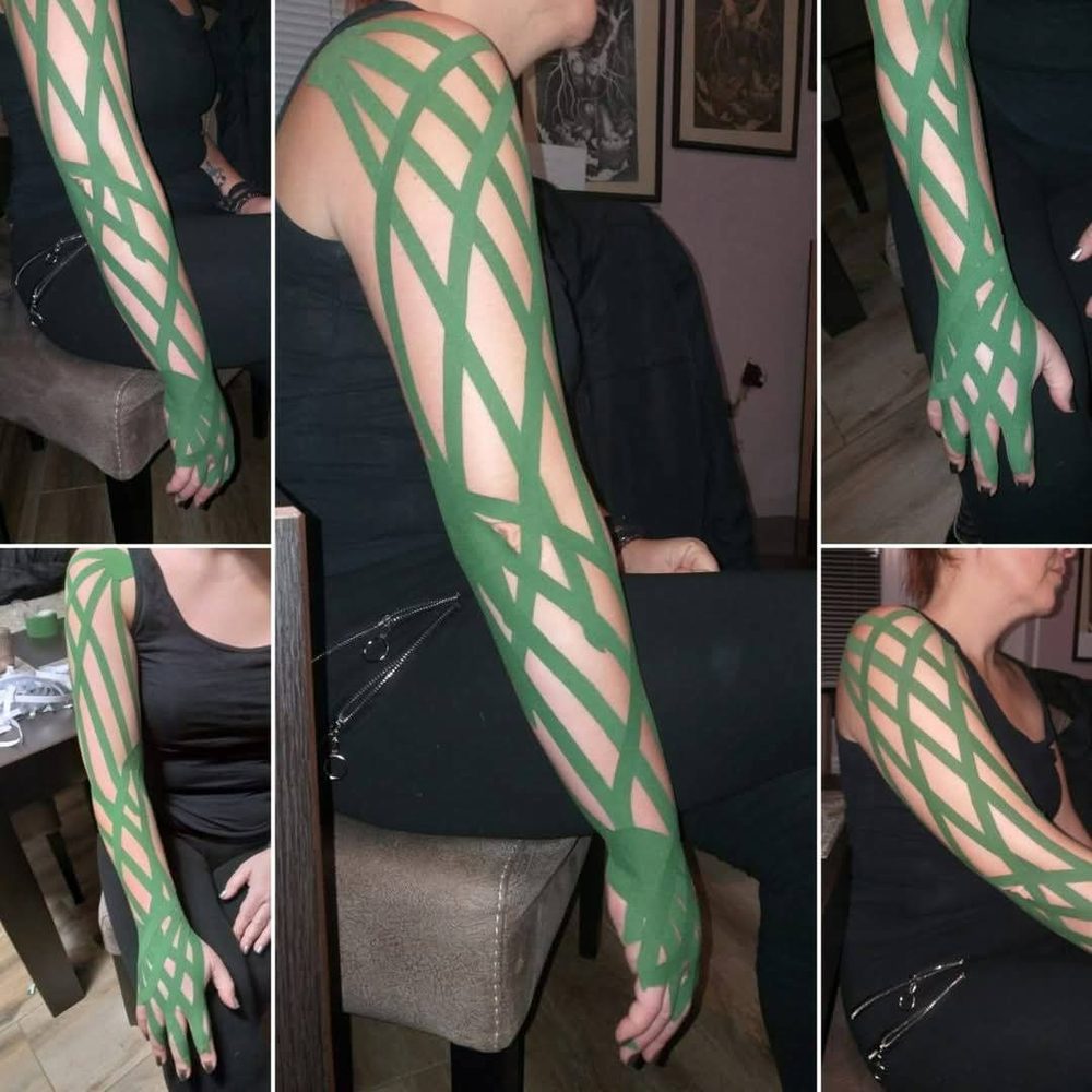 Kinezio taping - ruka
