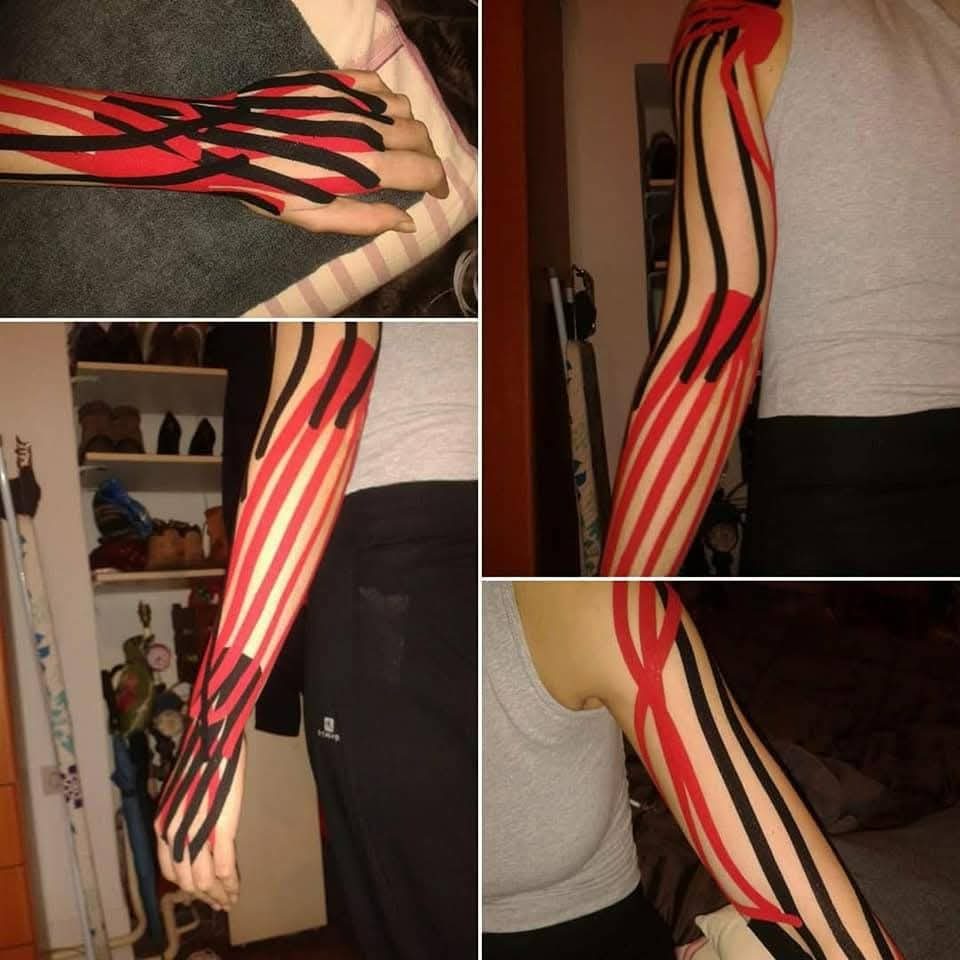 Kinezio taping - ruka i šaka