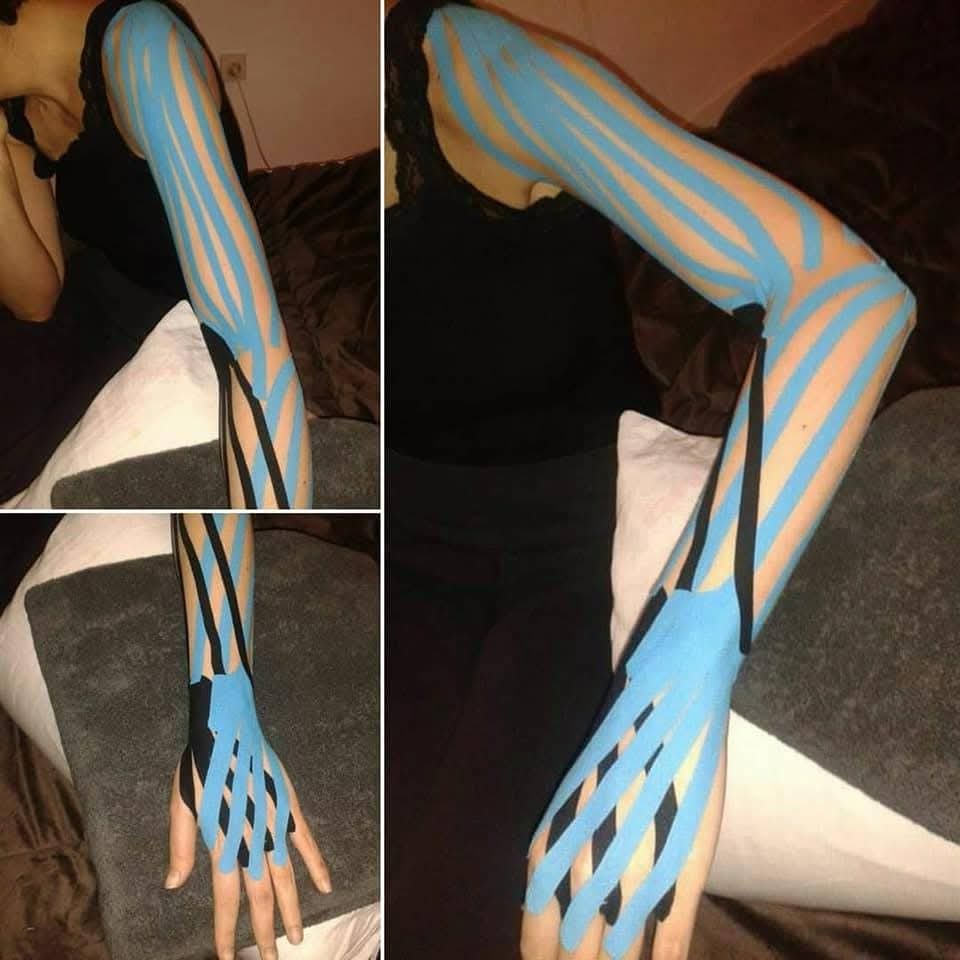 Kinezio taping - noga