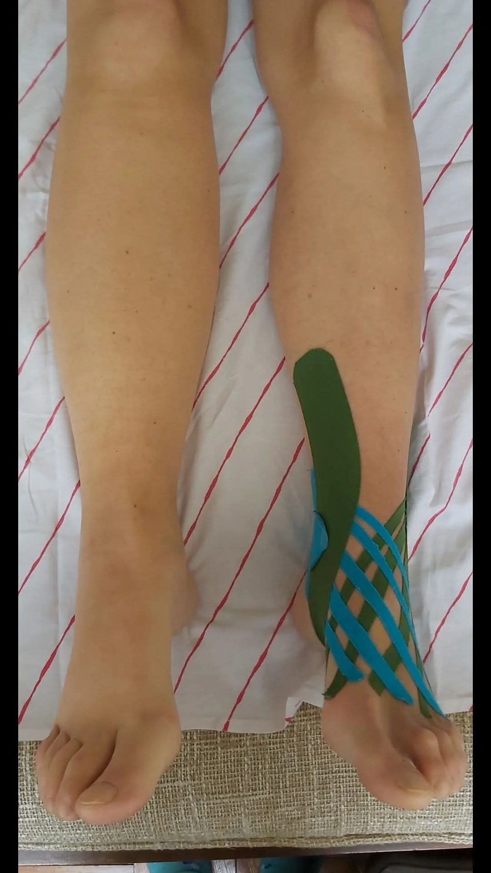 Kinezio taping - ruka