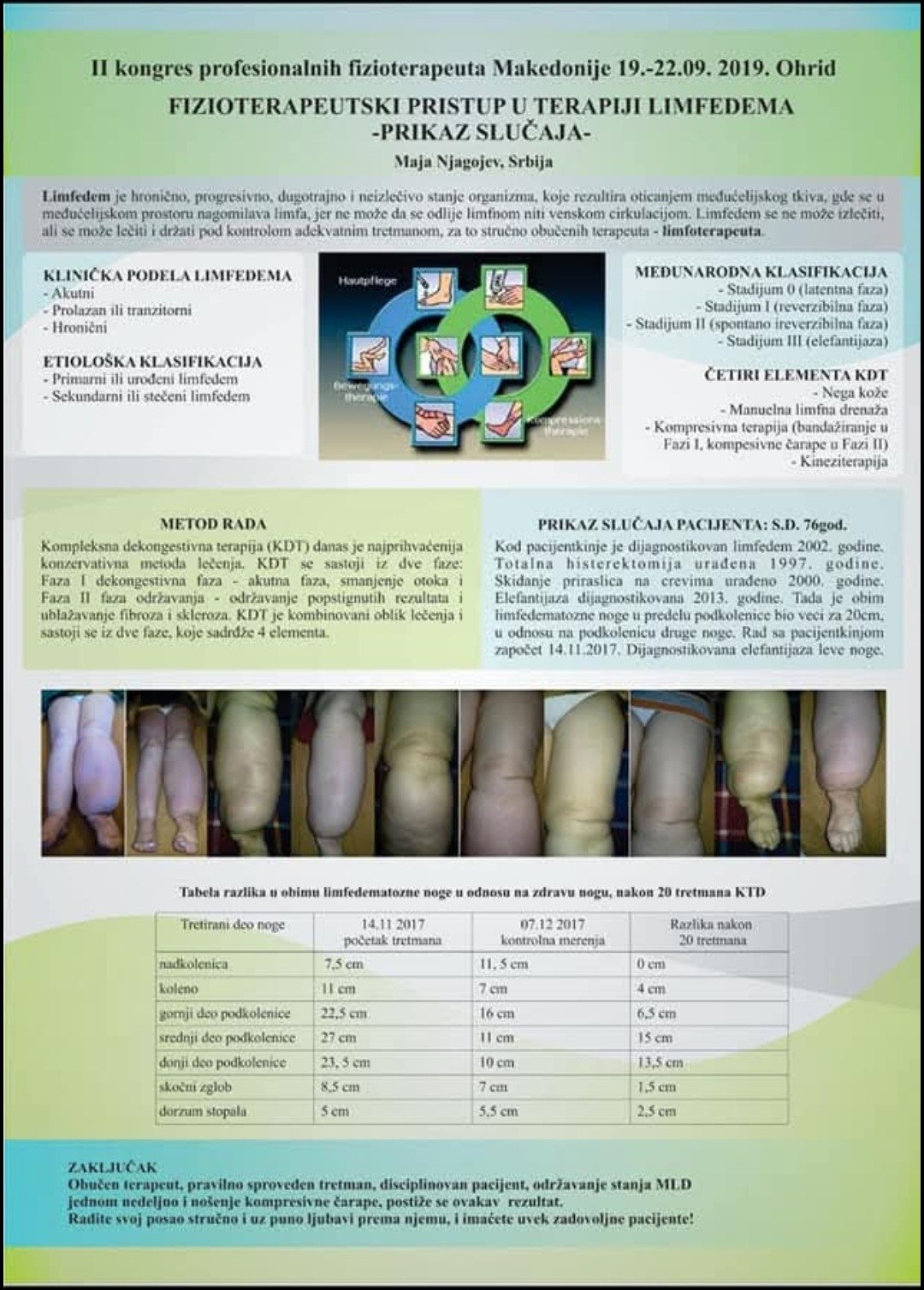 Prikaz slučaja - II kongres profesionalnih fizioterapeuta Makedonije, Ohrid 2019